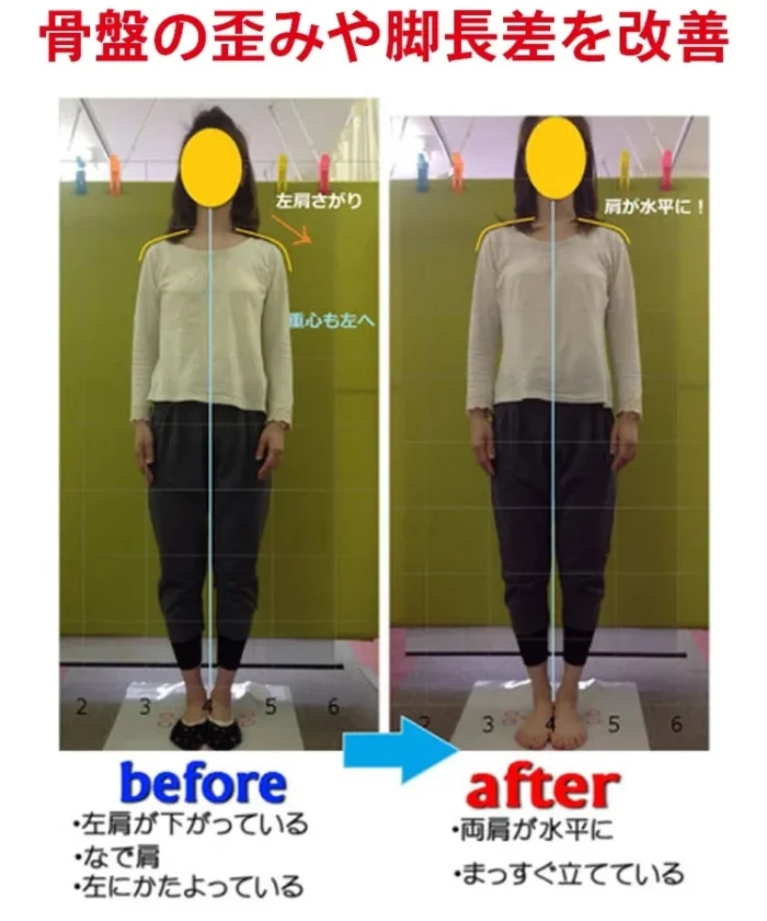 透かし彫りの厚底スリッポンレディース - 图片 3
